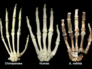A. ediba Hand comparison-Not to scale