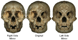 H. Floresiensis skull, adapted from Jacob et al, 2006