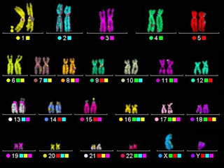 Human Chromosomal Karyotype
